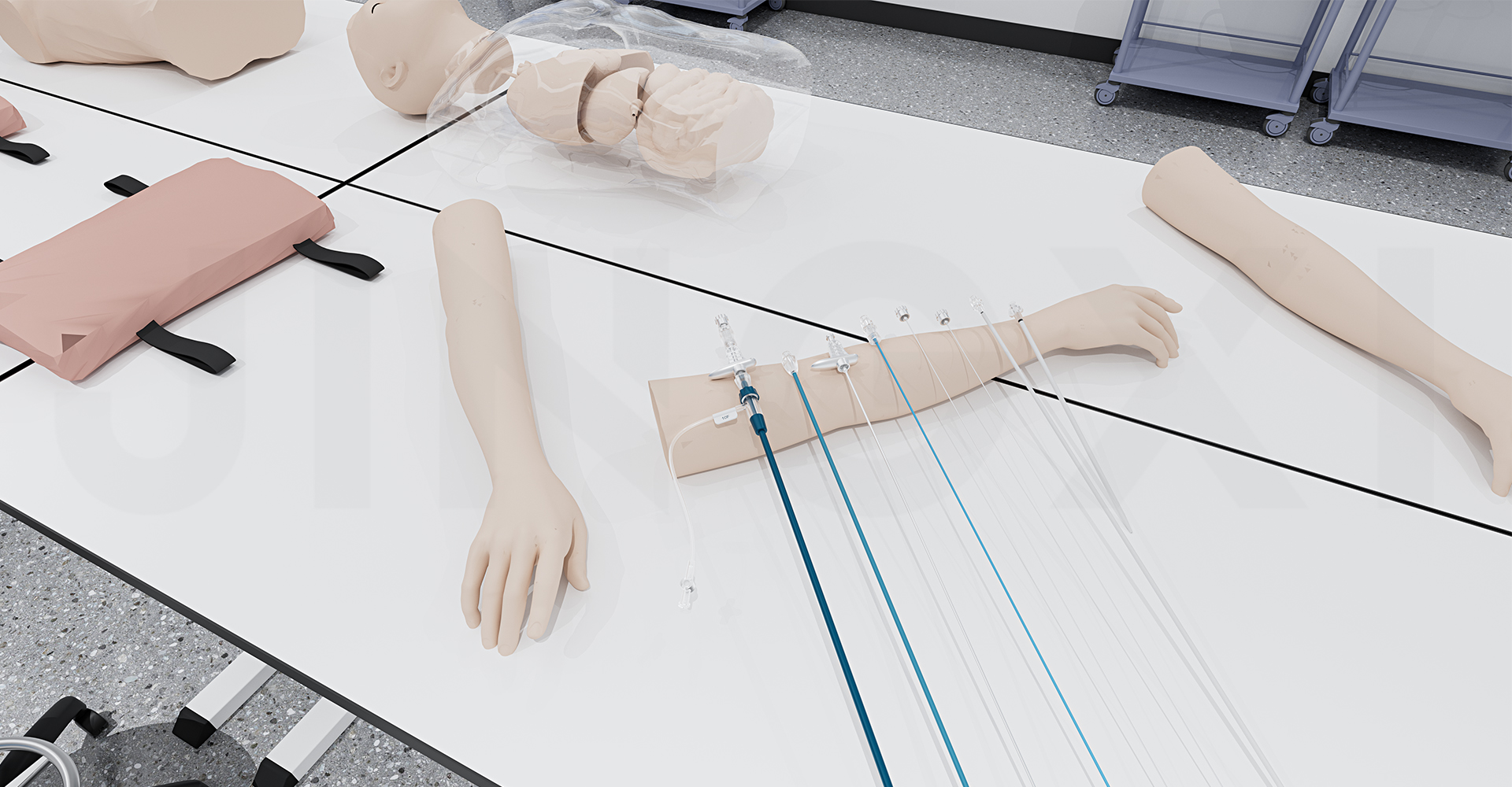 TIPS穿刺套件设计